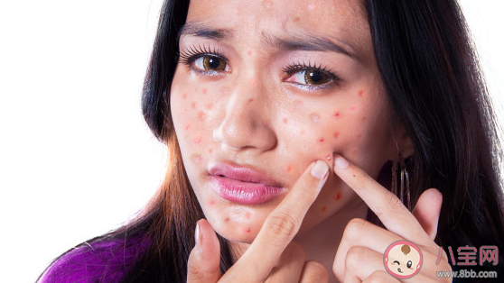 柳絮引起过敏皮肤痒去医院前可以 蚂蚁庄园4月19日答案介绍 柳絮引起过敏皮肤痒去医院前可以 蚂蚁庄园4月19日答案介绍