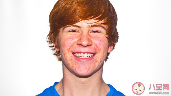 柳絮引起过敏皮肤痒去医院前可以 蚂蚁庄园4月19日答案介绍 柳絮引起过敏皮肤痒去医院前可以 蚂蚁庄园4月19日答案介绍