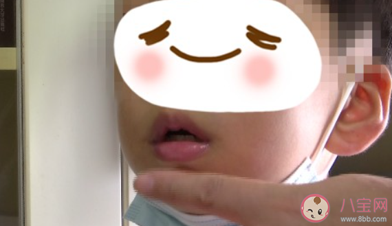 封口贴是智商税吗 要不要给孩子用封口贴 封口贴是智商税吗 要不要给孩子用封口贴