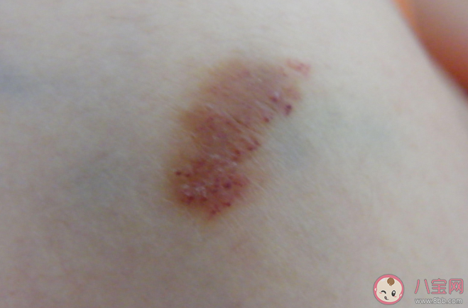 蚂蚁庄园有伤口不能吃酱油这种说法有科学依据吗 4月12日答案解析 蚂蚁庄园有伤口不能吃酱油这种说法有科学依据吗 4月12日答案解析