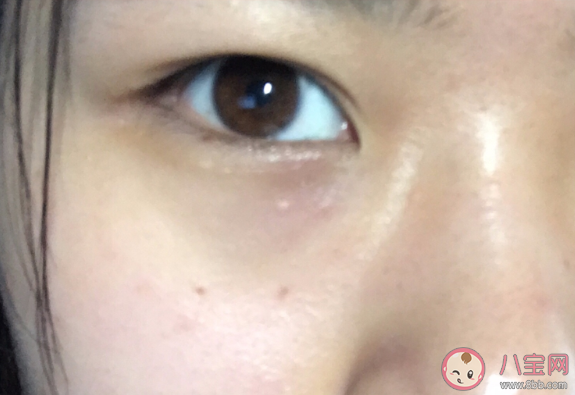 菲洛嘉逆时光精华好用吗 菲洛嘉逆时光精华使用感受 菲洛嘉逆时光精华好用吗 菲洛嘉逆时光精华使用感受