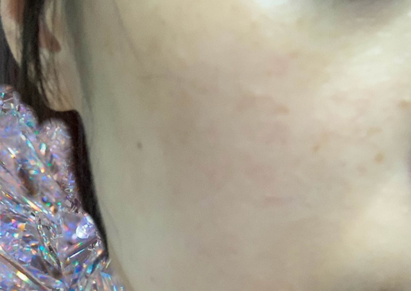 娇兰黄金复原蜜适合冬天用吗 娇兰黄金复原蜜什么适合人群 娇兰黄金复原蜜适合冬天用吗 娇兰黄金复原蜜什么适合人群