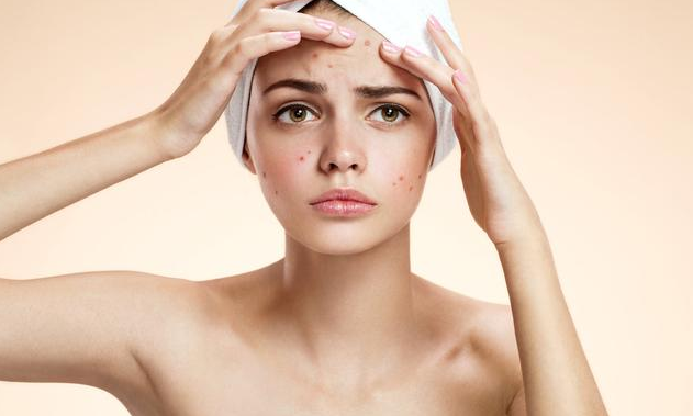 哪些行为习惯会导致毛孔粗大 收缩毛孔粗大5个小方法