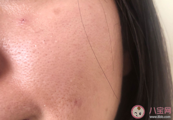 倩碧维C安瓶精华液效果好不好 倩碧维C安瓶精华液七天使用对比