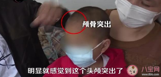 蛋白固体饮料/婴幼儿配方奶粉/特医奶粉有什么区别 ​蛋白固体饮料对婴儿有什么危害