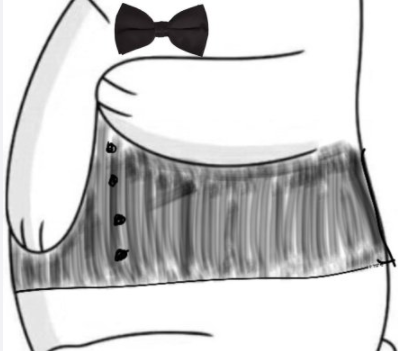 微信朋友圈小熊怎么发 微信朋友圈小熊升级版图片大全 微信朋友圈小熊怎么发 微信朋友圈小熊升级版图片大全