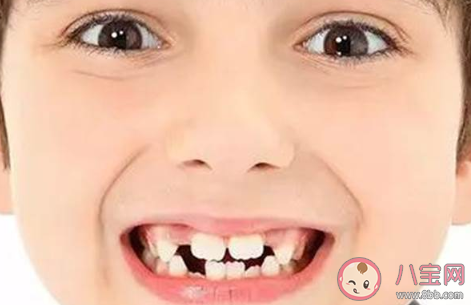 孩子换牙期间不爱吃饭怎么办 孩子换牙期间要注意些什么 孩子换牙期间不爱吃饭怎么办 孩子换牙期间要注意些什么