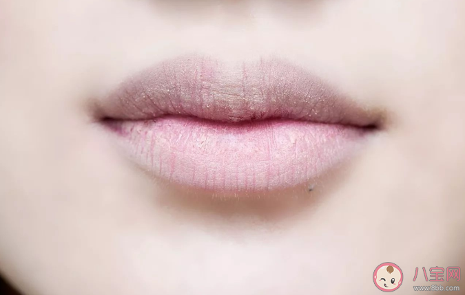 嘴唇干燥要多涂润唇膏吗 润唇膏哪些成分不推荐