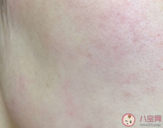 菲洛嘉十全大补面膜怎么样 菲洛嘉十全大补面膜试用测评