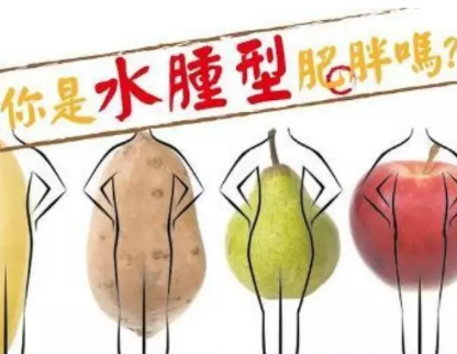 判断自己是不是水肿型肥胖 水肿型肥胖是怎么回事