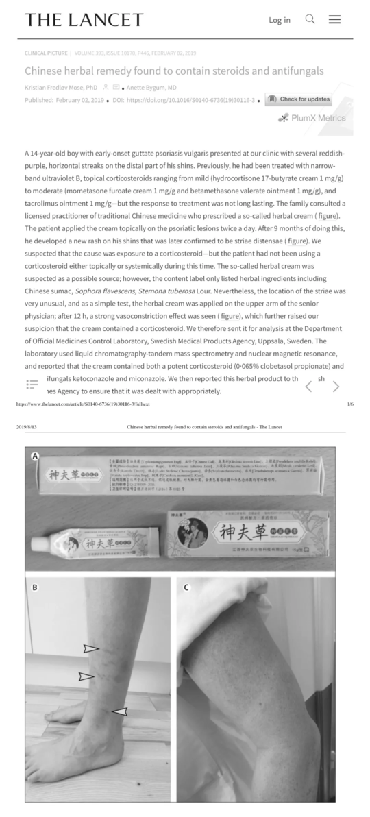 宝宝湿疹用品是消字号是怎么回事 消字号药品代表着什么 宝宝湿疹用品是消字号是怎么回事 消字号药品代表着什么