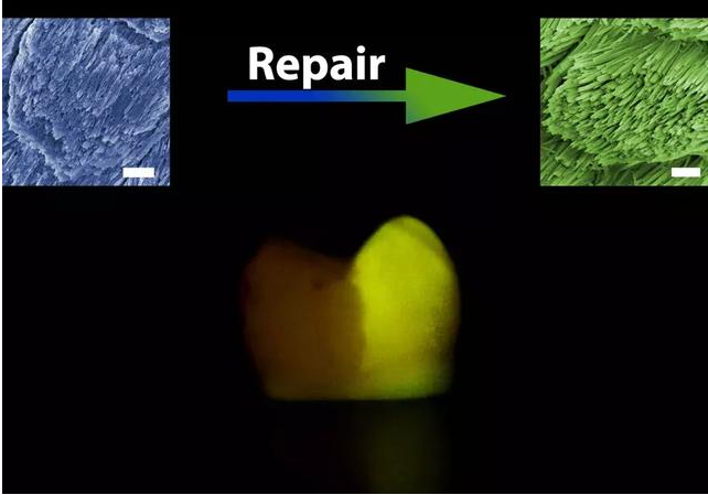 浙大学者发明神奇牙齿修复药水 牙齿修复药水能修复好牙齿是真的吗