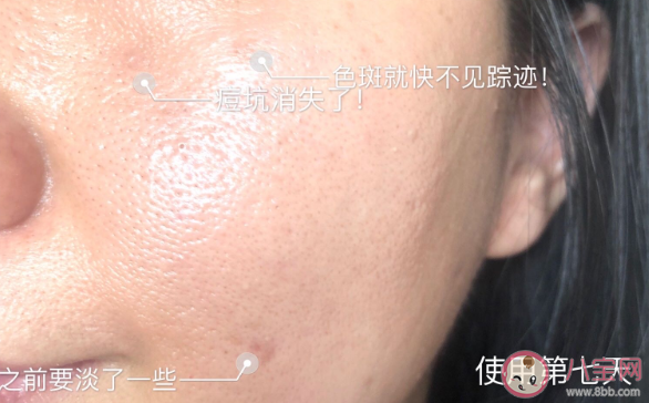 倩碧维C安瓶精华液效果好不好 倩碧维C安瓶精华液七天使用对比