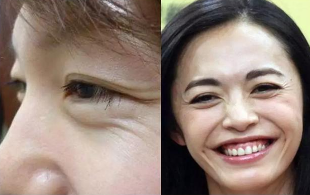 长相显老是一种什么感觉体验 长相显老的特征