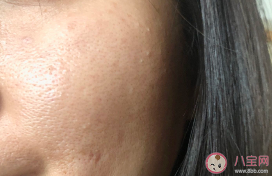 倩碧维C安瓶精华液效果好不好 倩碧维C安瓶精华液七天使用对比