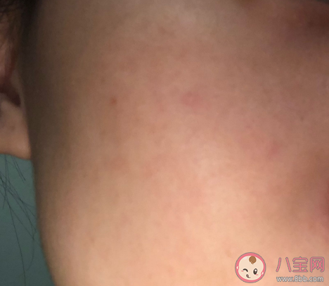 苏秘37精华露敏感肌能用吗 苏秘37精华露使用感受