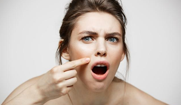 脸上有螨虫有什么特征 脸上有螨虫怎么祛除有效