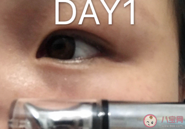 马应龙瞳话眼霜成分如何 马应龙瞳话眼霜试用效果