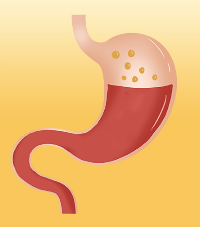 金丐醋酸钙颗粒钙含量怎么样 金丐醋酸钙颗粒好不好 金丐醋酸钙颗粒钙含量怎么样 金丐醋酸钙颗粒好不好