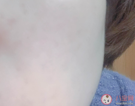 菲洛嘉十全大补面膜好用吗 菲洛嘉十全大补面膜成分分析 菲洛嘉十全大补面膜好用吗 菲洛嘉十全大补面膜成分分析