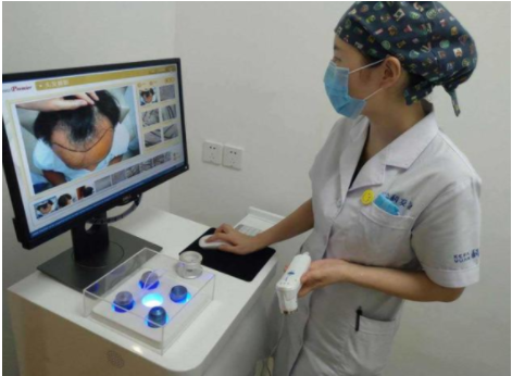 米诺地尔会加重脱发吗 米诺地尔治疗脱发的副作用