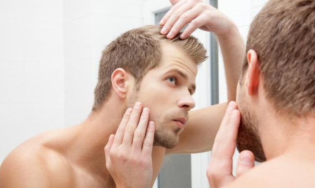 米诺地尔可以治疗脱发吗 米诺地尔狂脱期要持续多久