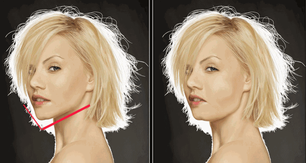 线雕用的线是什么线 PPDO线/PDO线/蛋白线有什么区别