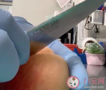 水蜜桃完美去皮方法 水蜜桃要去皮吃吗 水蜜桃完美去皮方法 水蜜桃要去皮吃吗