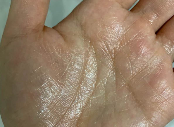 娇兰黄金复原蜜适合冬天用吗 娇兰黄金复原蜜什么适合人群 娇兰黄金复原蜜适合冬天用吗 娇兰黄金复原蜜什么适合人群