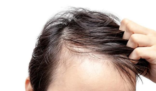 吃黑芝麻能让头发变黑吗 护发养发吃什么食物好