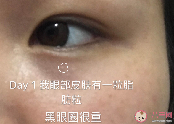马应龙瞳话眼霜成分如何 马应龙瞳话眼霜试用效果