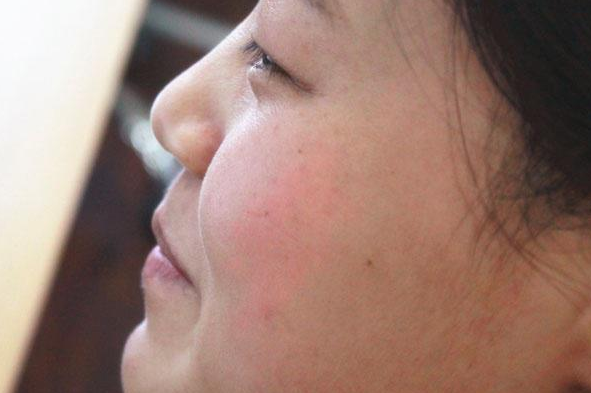 哪些行为习惯会导致毛孔粗大 收缩毛孔粗大5个小方法