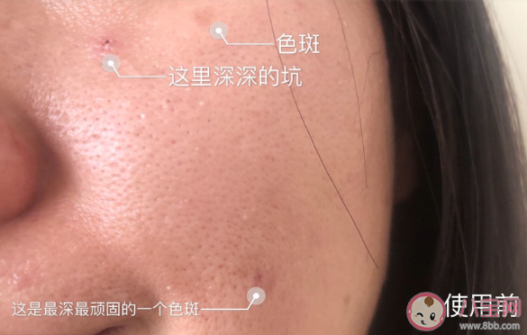 倩碧维C安瓶精华液效果好不好 倩碧维C安瓶精华液七天使用对比