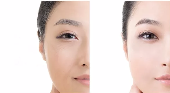 2019眼霜挑选全攻略 关于眼霜使用6大误区