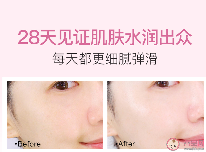 贝德美舒润保湿乳好不好用 贝德美舒润保湿乳适合什么肤质