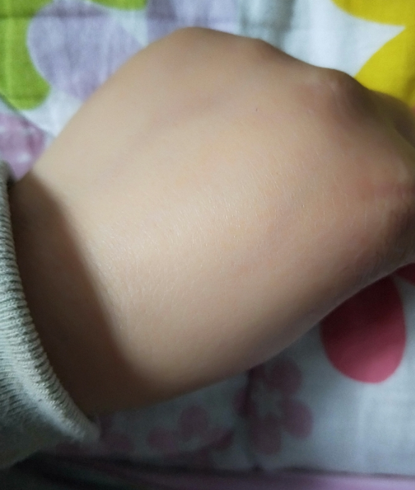 御方宝贝植物护臀膏油不油 御方宝贝植物护臀膏好不好