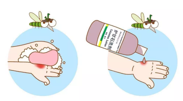 不同年龄段怎么给孩子驱蚊 孩子被蚊子咬了怎么帮他止痒