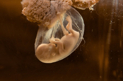 再馋也得忍住不吃的食物 这些食物会影响羊水的质量 再馋也得忍住不吃的食物 这些食物会影响羊水的质量