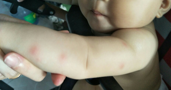 甘尼克宝贝驱蚊喷液怎么样 甘尼克宝贝驱蚊使用测评
