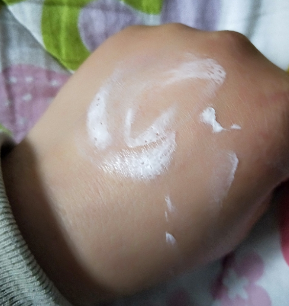 御方宝贝植物护臀膏油不油 御方宝贝植物护臀膏好不好