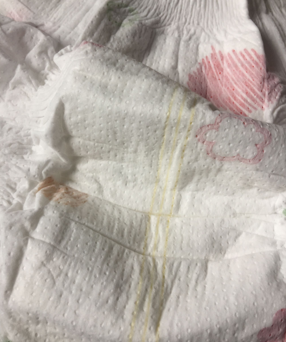 优树纤薄呼吸纸尿裤闷不闷 优树纤薄呼吸纸尿裤孩子用了会红屁屁吗