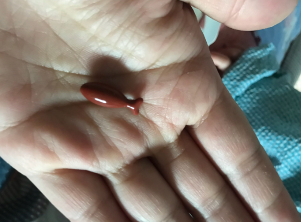 蜜牙贝贝补铁软胶囊口感怎么样 一次吃几颗蜜牙贝贝补铁软胶囊比较好