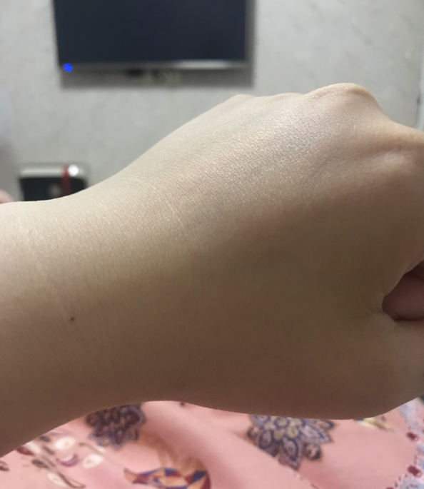 安慕斯婴儿湿疹膏怎么样 安慕斯婴儿湿疹膏试用测评