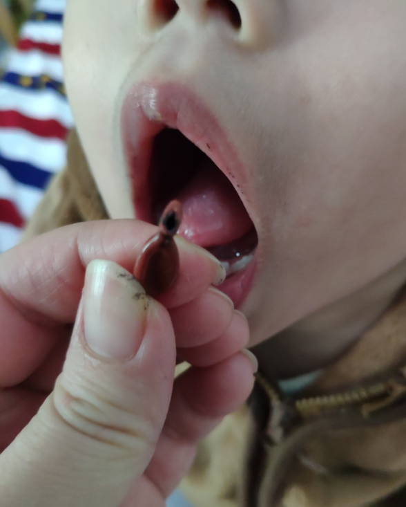 蜜牙贝贝补铁软胶囊好不好  蜜牙贝贝补铁软胶囊孩子愿意吃吗