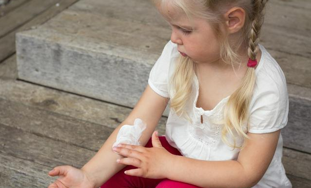 宝宝能用激素药膏吗 使用激素药膏 一定会有副作用吗