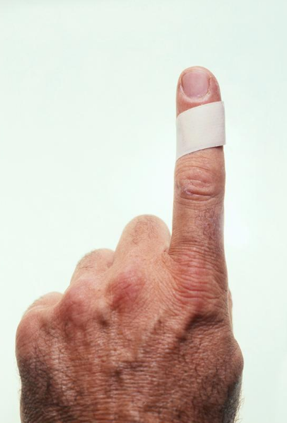 创可贴是什么垃圾 创可贴是干垃圾还是湿垃圾 创可贴是什么垃圾 创可贴是干垃圾还是湿垃圾