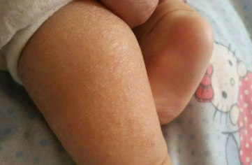 宝宝秋季怎么补充维生素 秋季补充维生素方法