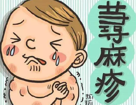 春天宝宝花粉过敏怎么办 宝宝花粉过敏症怎么治疗