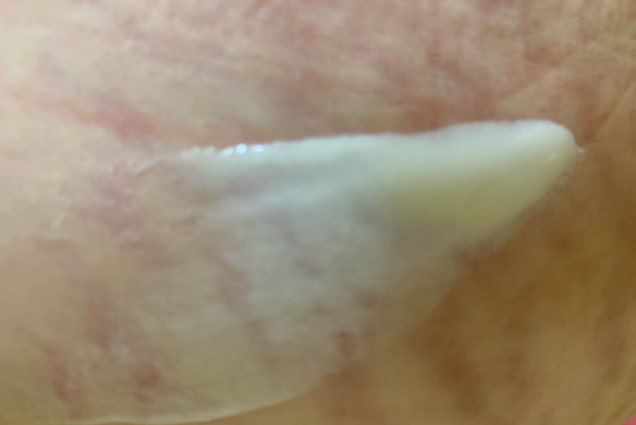 Pregnacares妊娠纹修复乳怎么样 Pregnacares妊娠纹修复乳试用测评 Pregnacares妊娠纹修复乳怎么样 Pregnacares妊娠纹修复乳试用测评