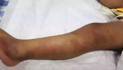 1岁女童被摔死怎么回事 1岁女童被母亲男友摔死原因